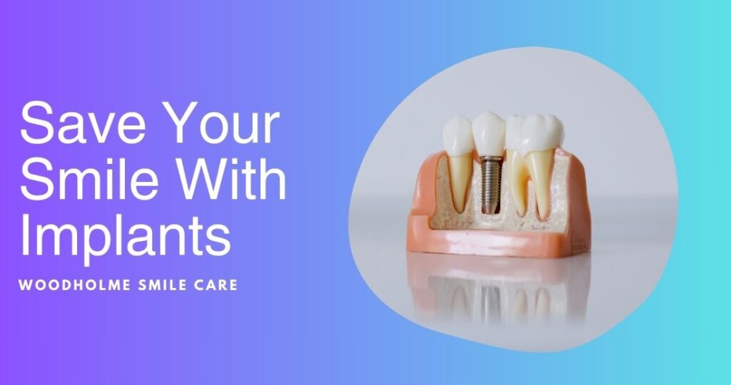Benefits of dental implants in Pikesville MD